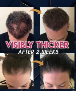 خلاصة نمو الشعر النقي