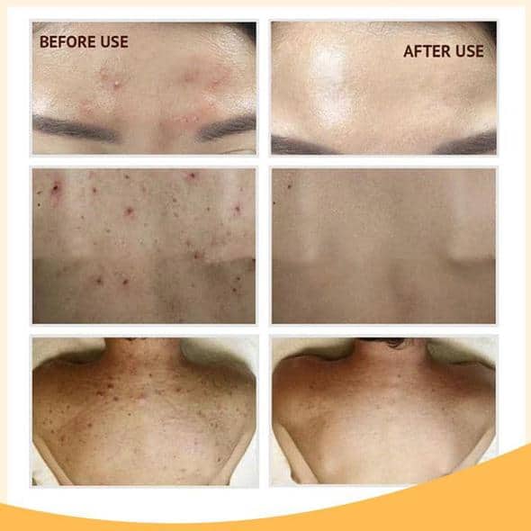 مجموعة سيروم التفتيح ريتينول سي+ - Image 10