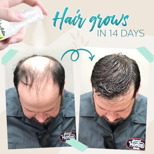 رذاذ الزنجبيل المنشط للشعر - Image 2