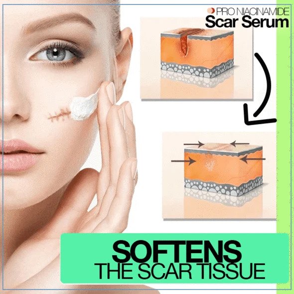 مصل الندبات PRO Niacinamide - Image 2