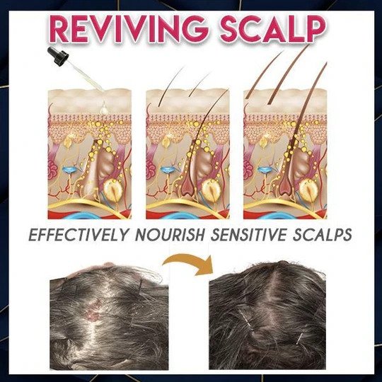 خلاصة نمو الشعر النقي - Image 2