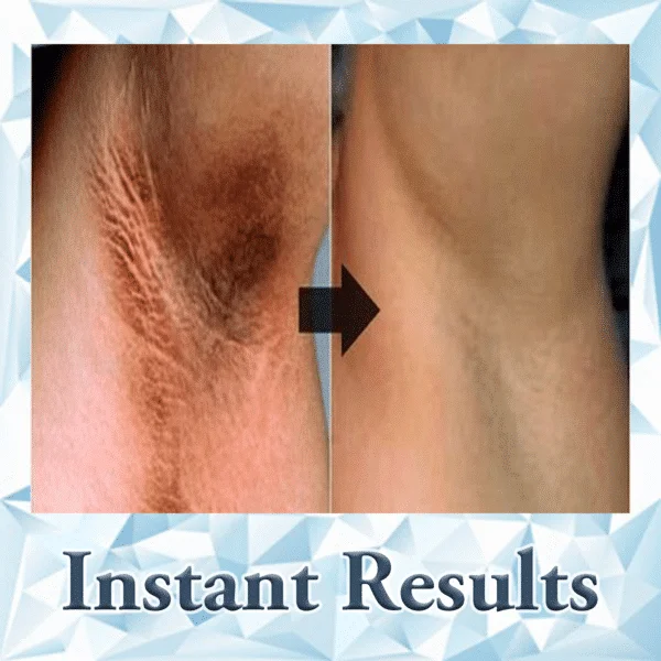 مجموعة ROLLY Sasher (30 مقطع تثبيت مجاني) - Image 6