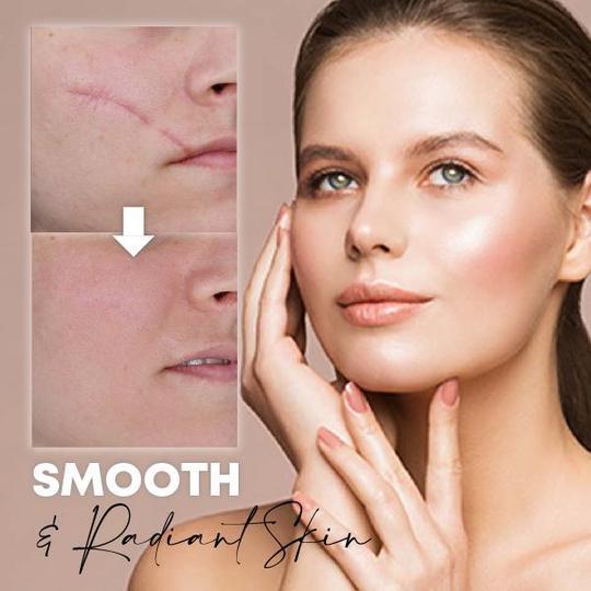 كريم ارتداد البشرة من ميديس - Image 3