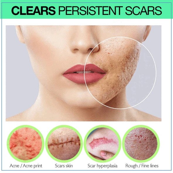 مصل الندبات PRO Niacinamide - Image 3