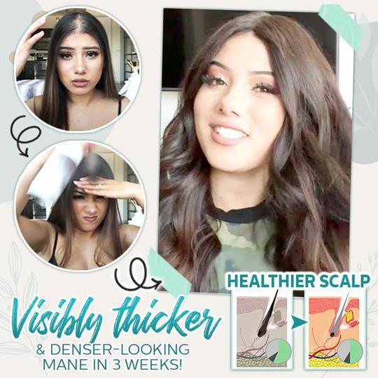 رذاذ الزنجبيل المنشط للشعر - Image 4