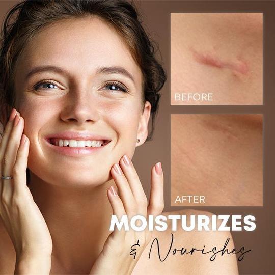 كريم ارتداد البشرة من ميديس - Image 4