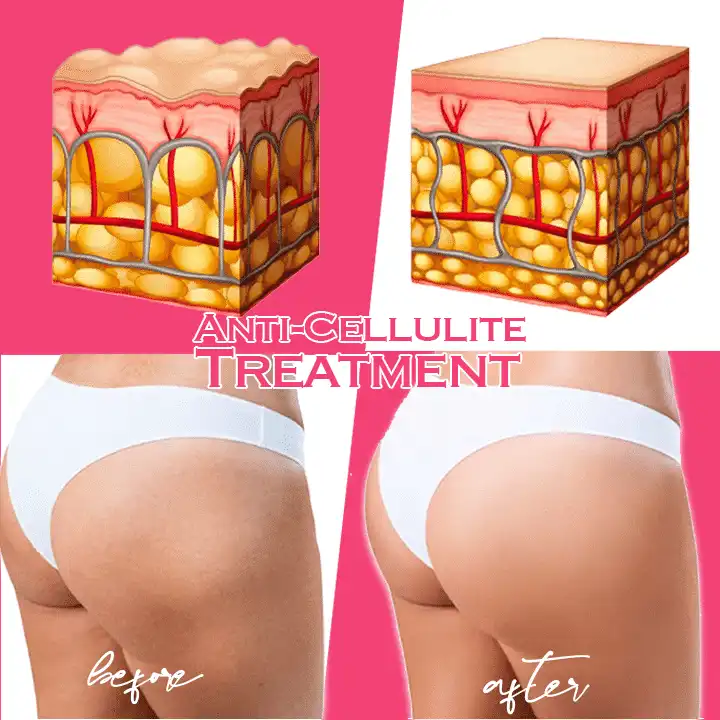 كريم الكافيين القوي واللون - Image 4