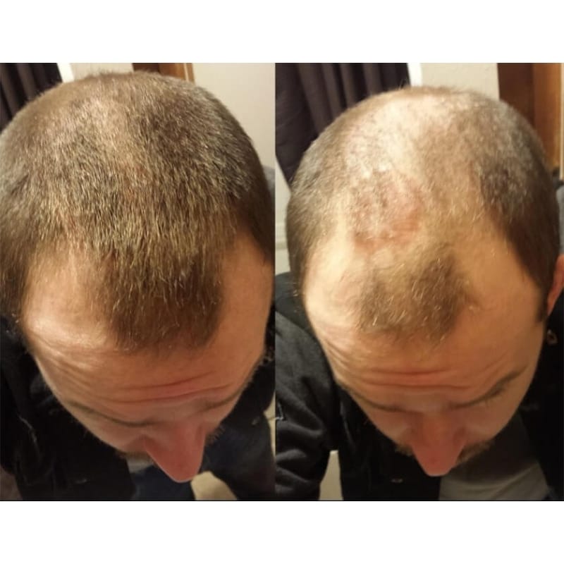 ألياف بناء الشعر - Image 5