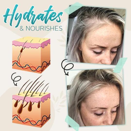 رذاذ الزنجبيل المنشط للشعر - Image 5