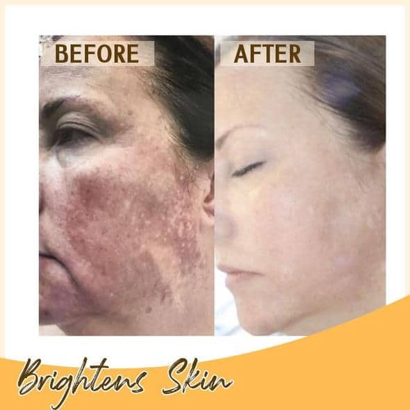 مجموعة سيروم التفتيح ريتينول سي+ - Image 6