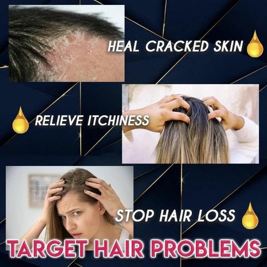 خلاصة نمو الشعر النقي - Image 6