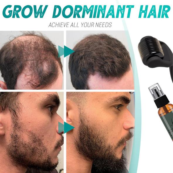 مجموعة بكرات نمو اللحية - Image 6