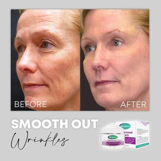 كريم ارتداد البشرة من ميديس - Image 7