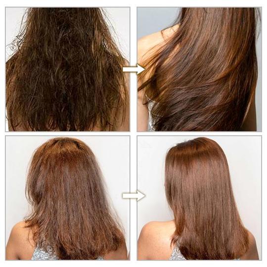 كبسولة مصل فيتامين هيراكل - Image 9