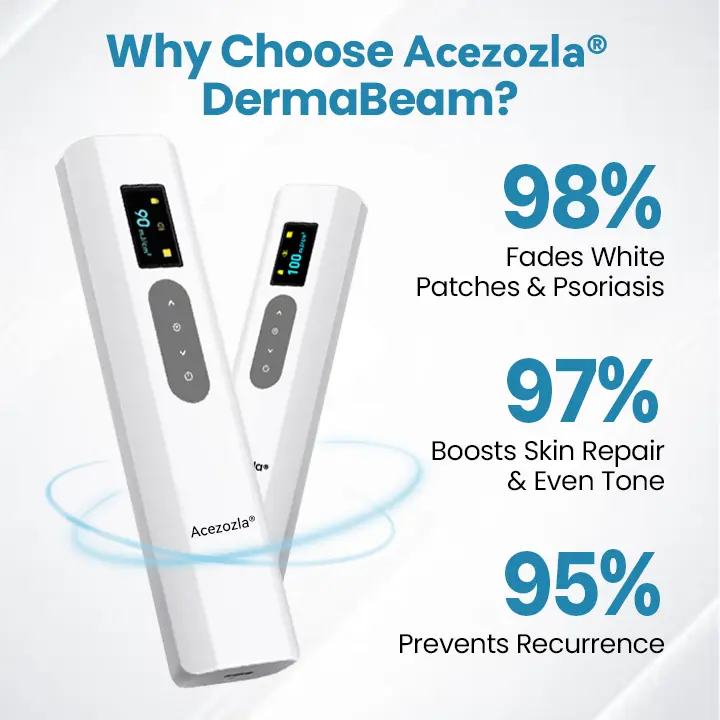 جهاز علاج البهاق Acezozla® DermaBeam - Image 6