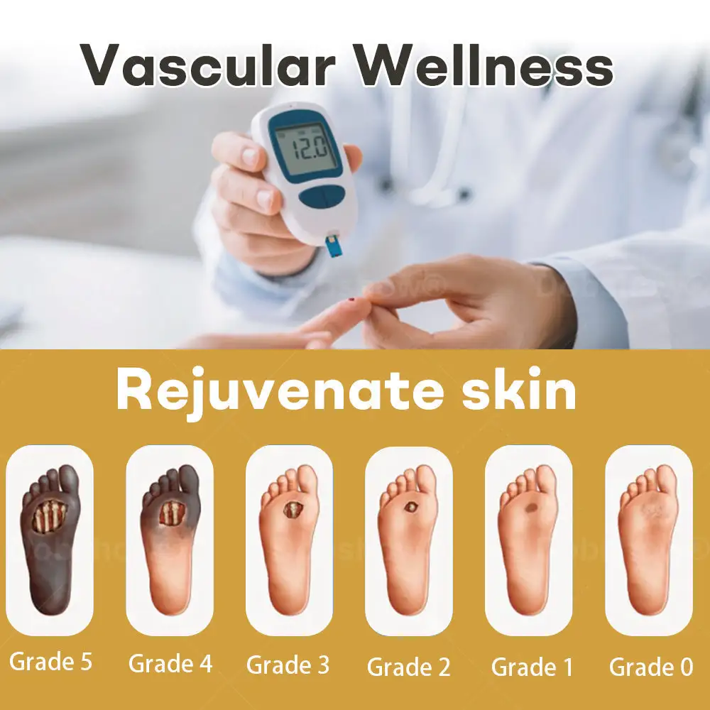 Acezozla® GlucoShield رذاذ سم النحل للجروح - Image 2