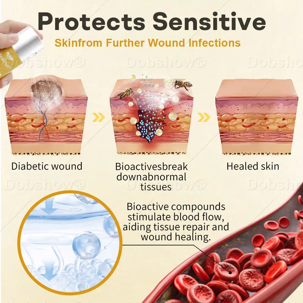 Acezozla® GlucoShield رذاذ سم النحل للجروح - Image 3