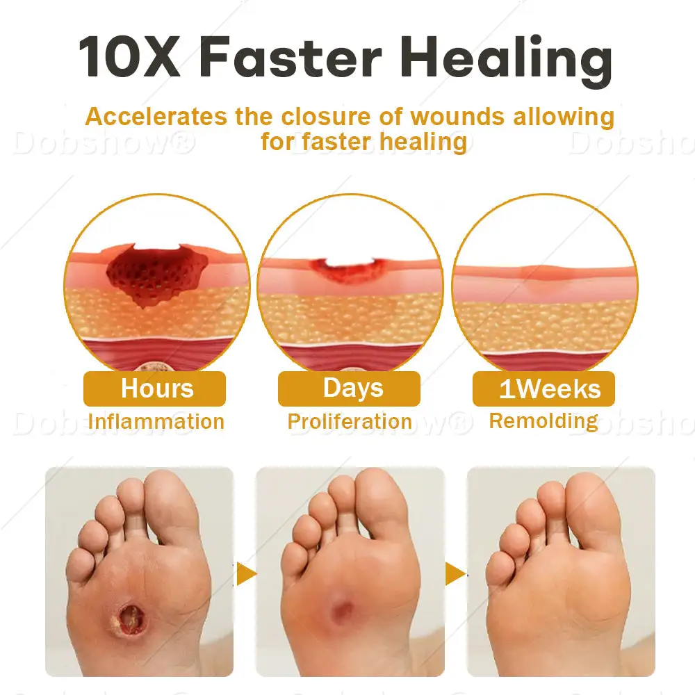 Acezozla® GlucoShield رذاذ سم النحل للجروح - Image 4