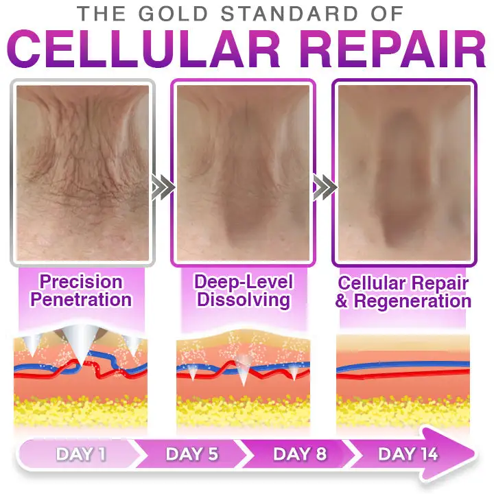 CareBreeze® 3-in-1 Microneedle Anti-Ageing Patch - Image 3