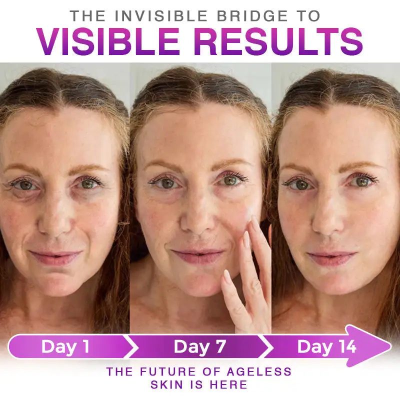 CareBreeze® 3-in-1 Microneedle Anti-Ageing Patch - Image 5