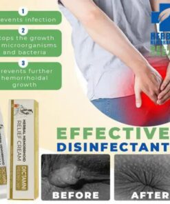 مرهم علاج البواسير Hemorelief