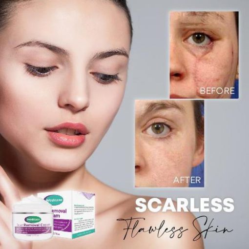 كريم ارتداد البشرة من ميديس